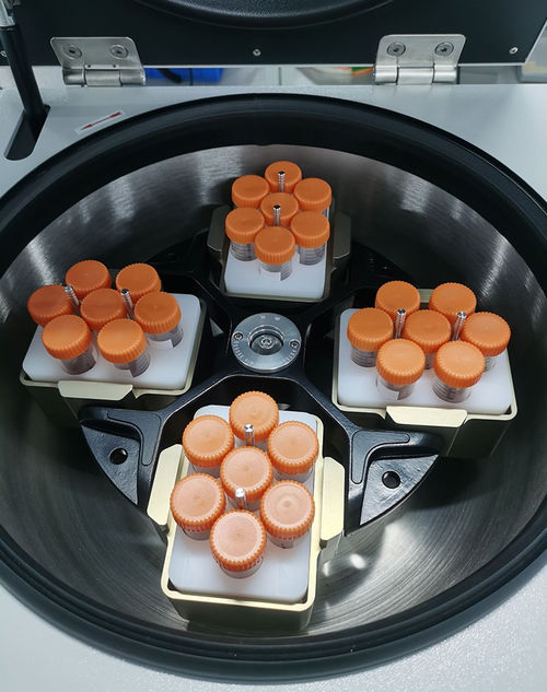 China Hunan Xiangyi Laboratory Instrument Development Co Ltd Latest